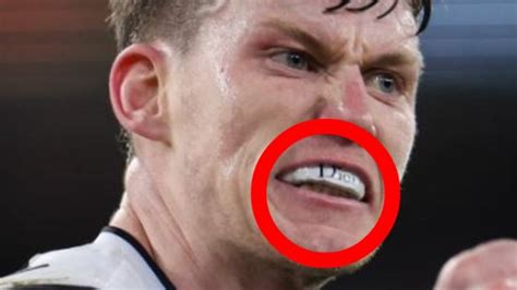 Carlton clarify viral detail in Sam Walsh’s mouthguard